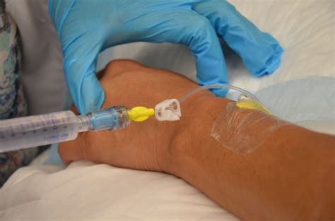 Today, saline lock has been forgotten in many hospitals. Based on the results of this study, nurses, especially in the cardiac care units, can be taught and encouraged to use this method. By expressing its useful features, this method can be replaced by the routine care methods of peripheral venous catheter.